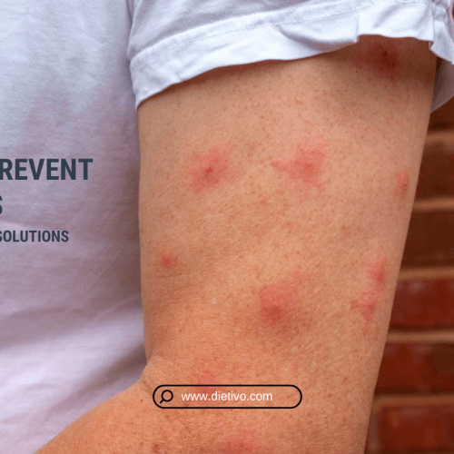 remedies to prevent bug bites